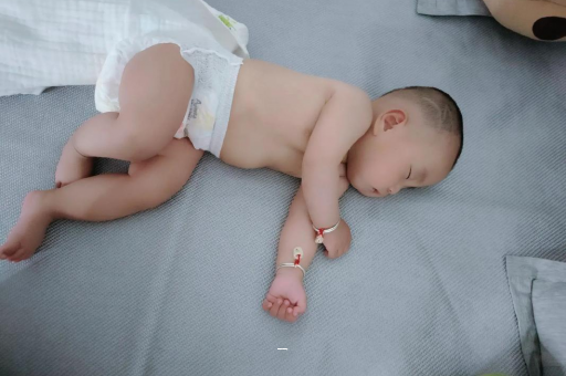 汝州宝宝脸上有白色斑块